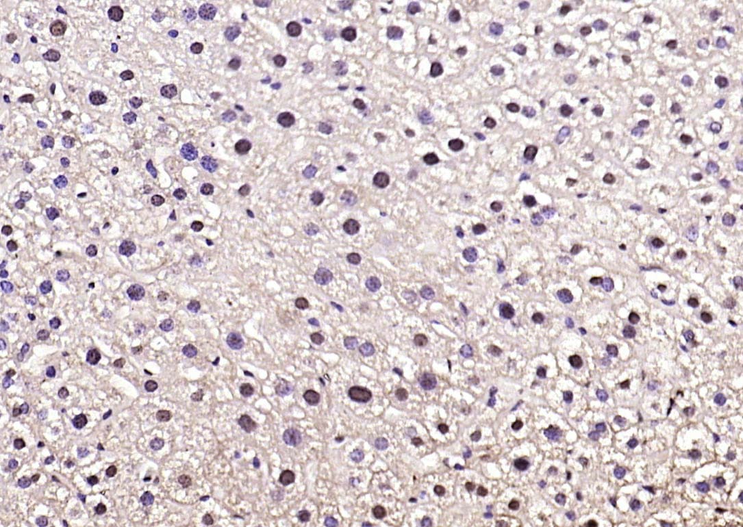 Anti-Phospho-FOXO1 (Ser319) Polyclonal Antibody