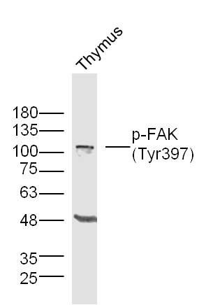 Anti-Phospho-FAK (Tyr397) Polyclonal Antibody