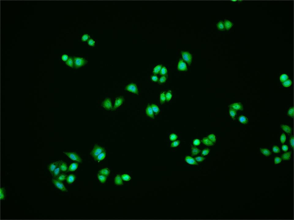 Anti-Phospho-FAK (Tyr397) Polyclonal Antibody