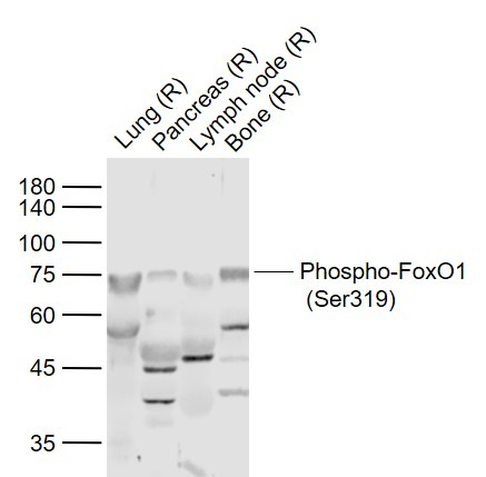 Anti-Phospho-FOXO1 (Ser319) Polyclonal Antibody