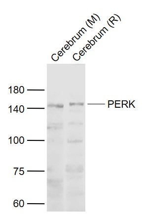 Anti-PERK Polyclonal Antibody