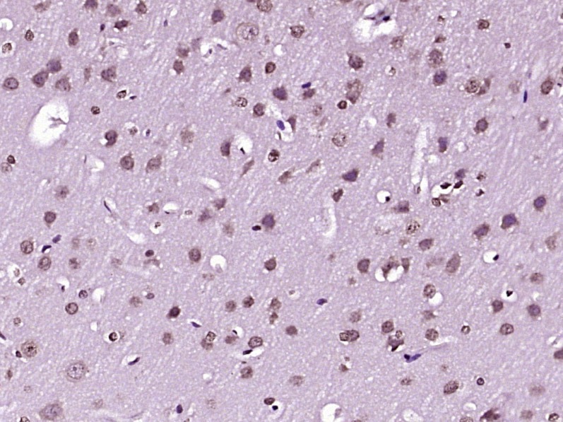 Anti-Phospho-FOXO1 (Ser256) Polyclonal Antibody