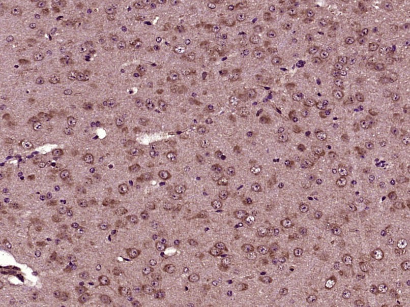 Anti-Phospho-AKT (Ser473) Antibody (9L992)