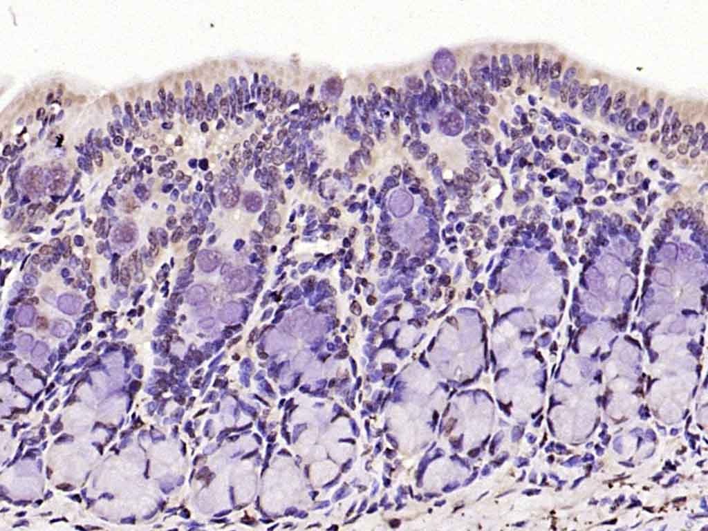Anti-Phospho-FOXO1 (Ser256) Polyclonal Antibody