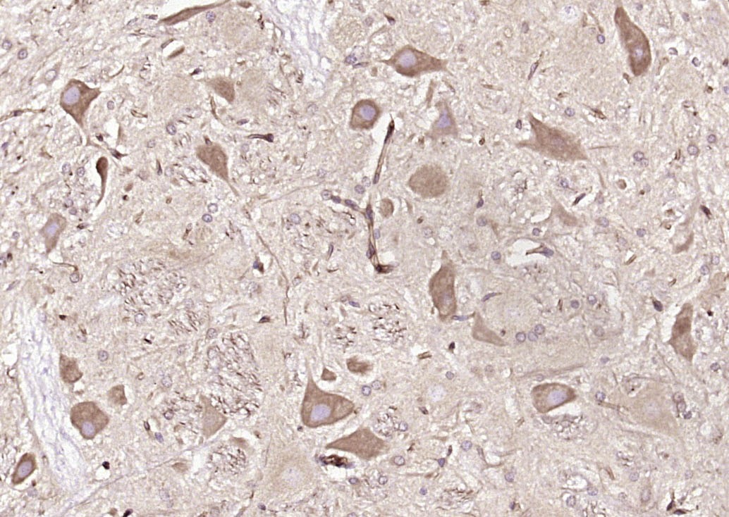 Anti-PFKM Polyclonal Antibody