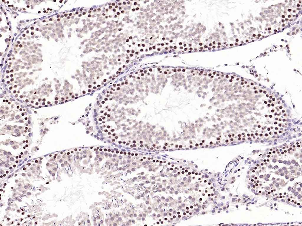 Anti-Phospho-FOXO1 (Ser256) Polyclonal Antibody