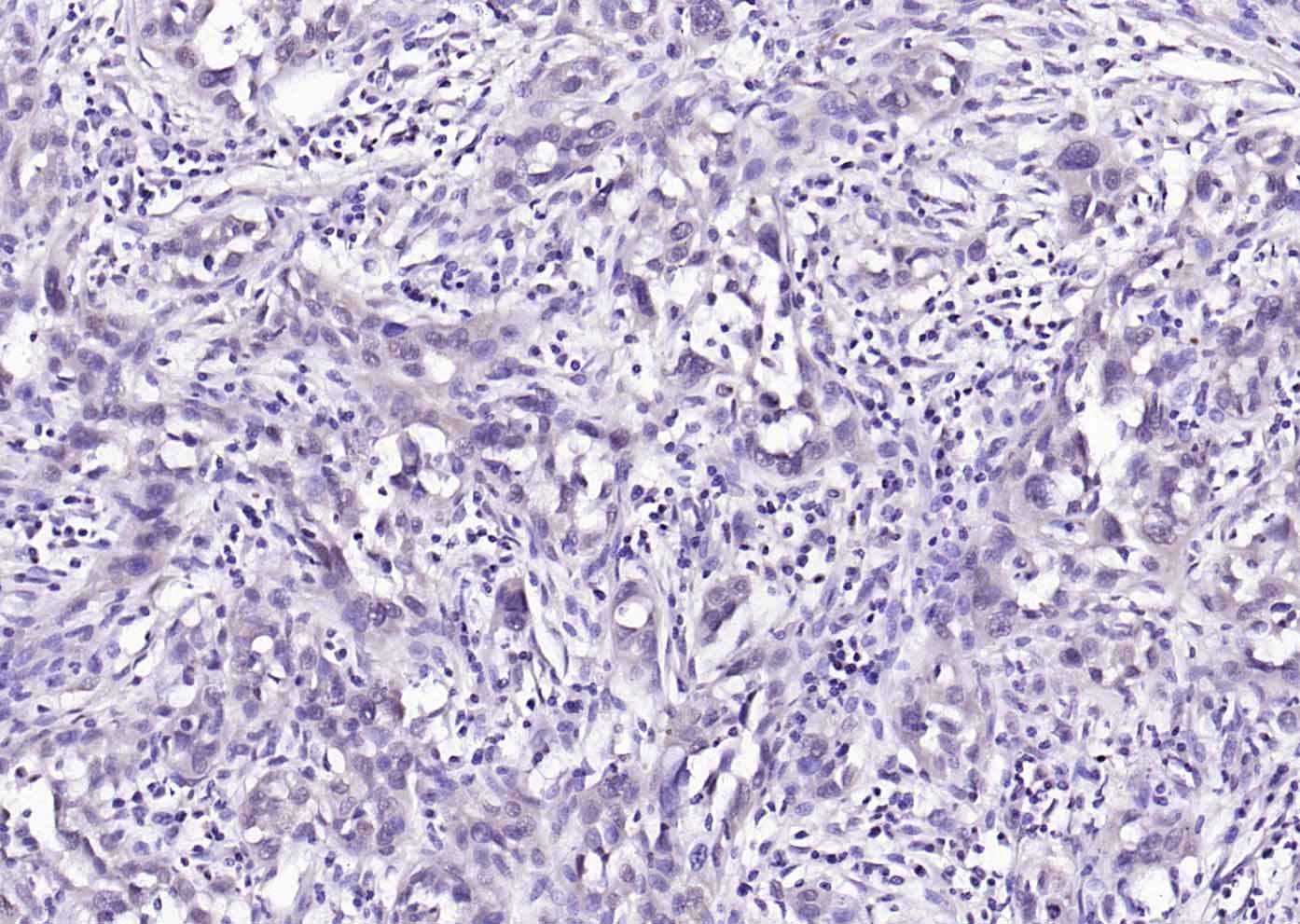 Anti-Phospho-AKT (Ser473) Antibody (9L992)