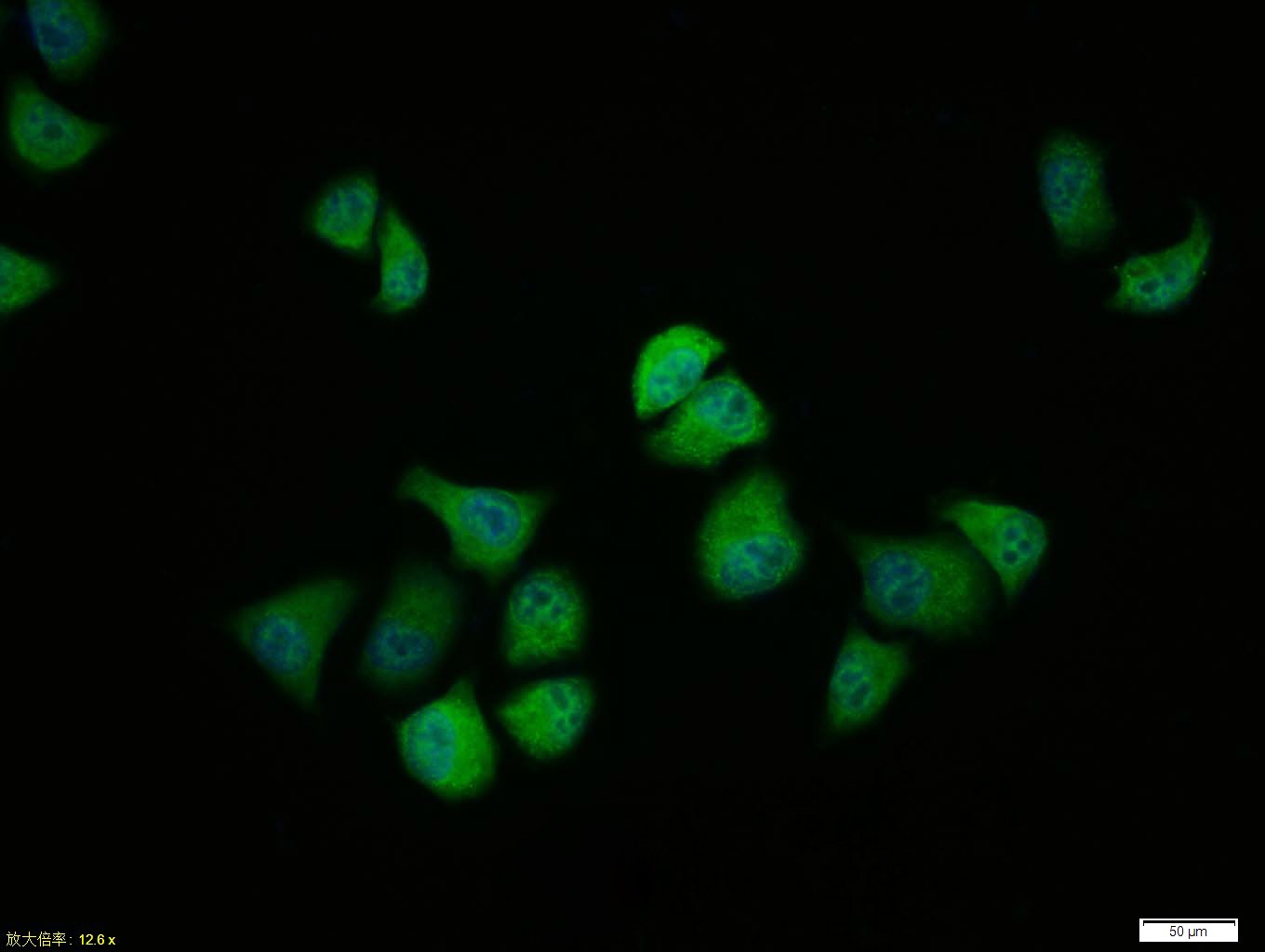 Anti-Phospho-GSK3B (Ser9) Polyclonal Antibody