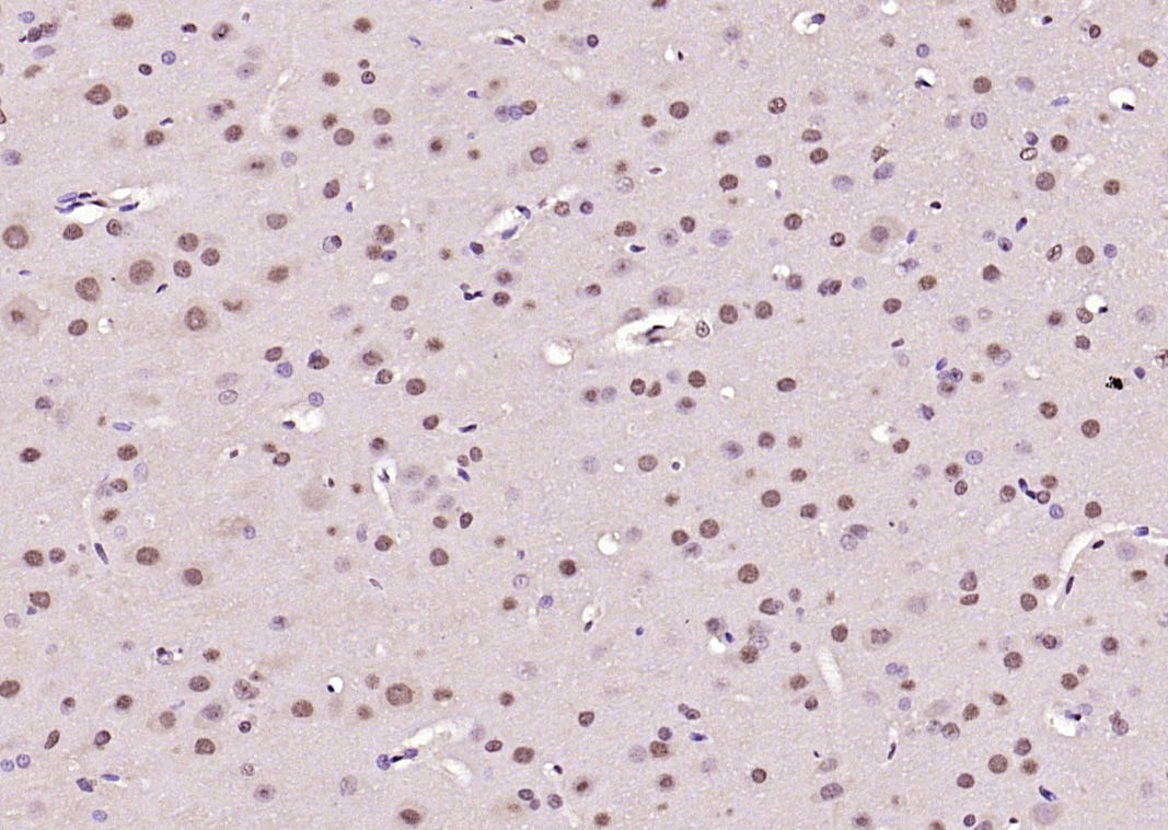 Anti-Phospho-FOXO1 (Ser319) Polyclonal Antibody