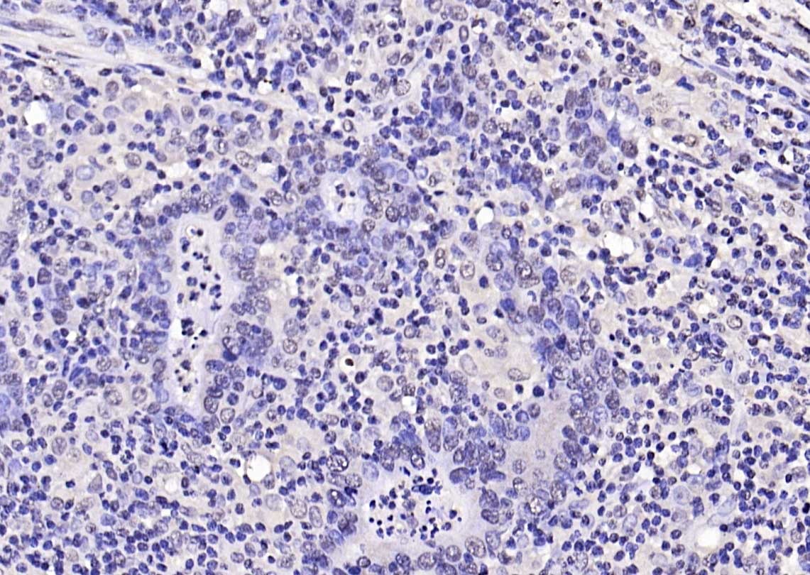 Anti-Phospho-FOXO1 (Ser319) Polyclonal Antibody