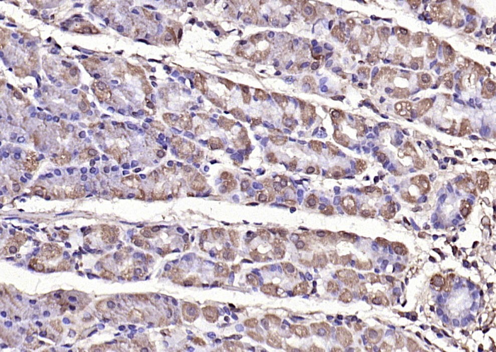 Anti-Phospho-FAK (Tyr397) Polyclonal Antibody