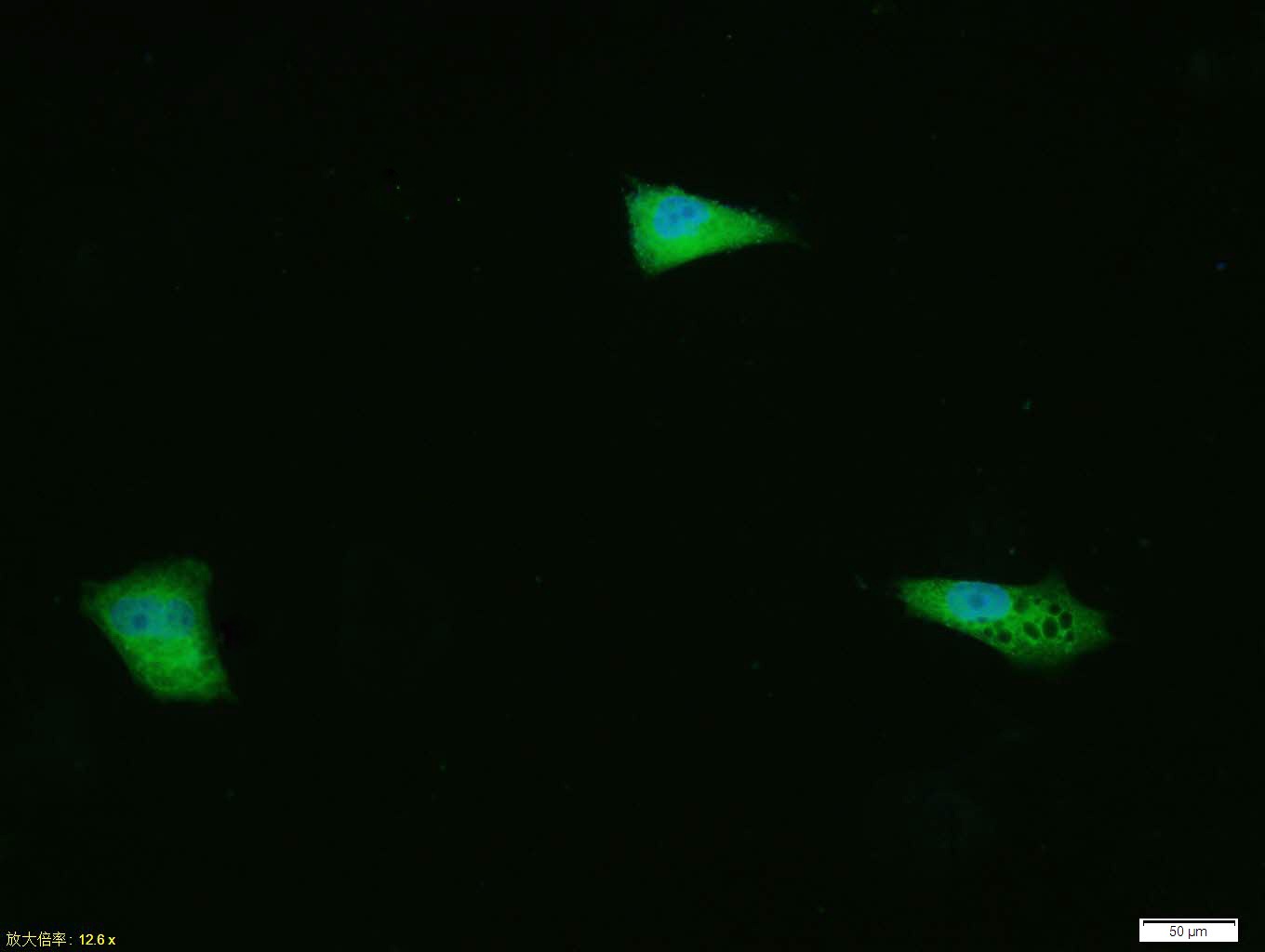 Anti-Phospho-ERK1/2 (Thr202 , Tyr204) Polyclonal Antibody