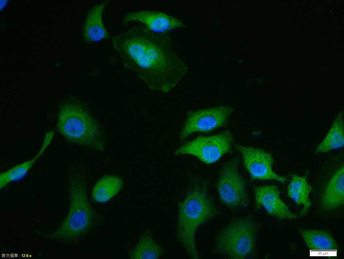 Anti-Phospho-ERK1/2 (Thr202 , Tyr204) Polyclonal Antibody