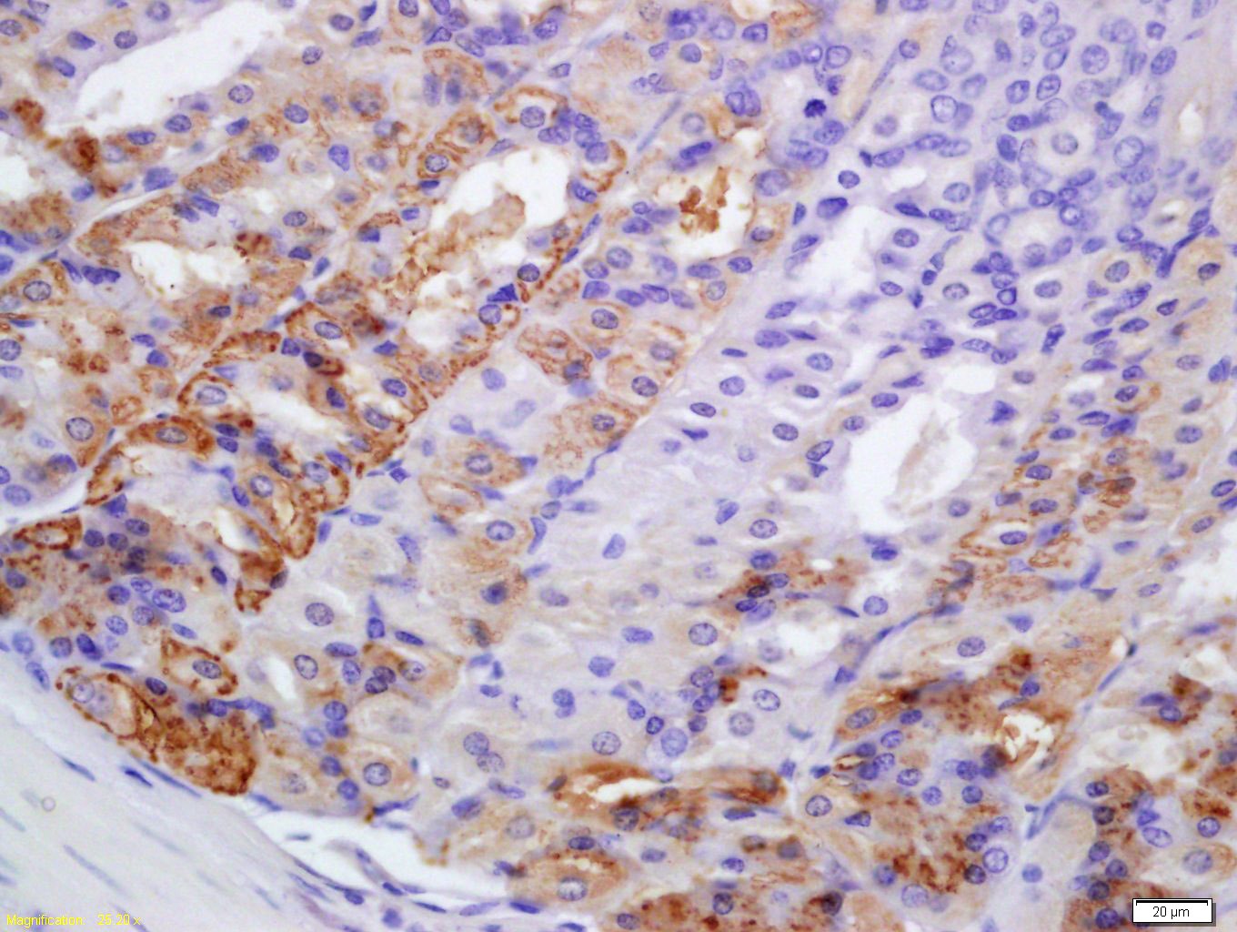 Anti-PERK Polyclonal Antibody