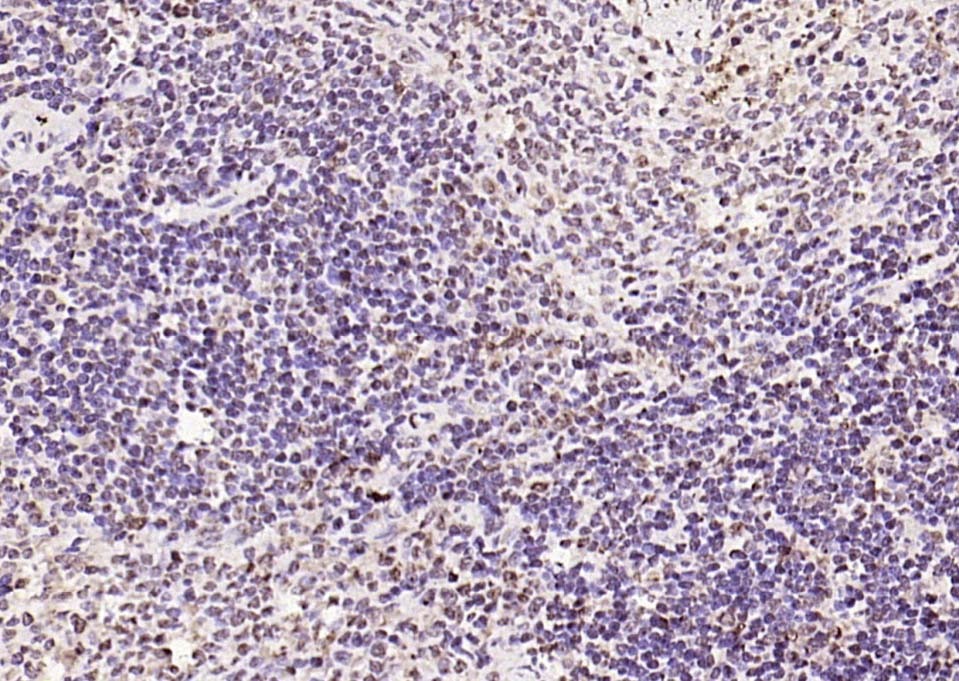 Anti-Phospho-FOXO1 (Ser319) Polyclonal Antibody