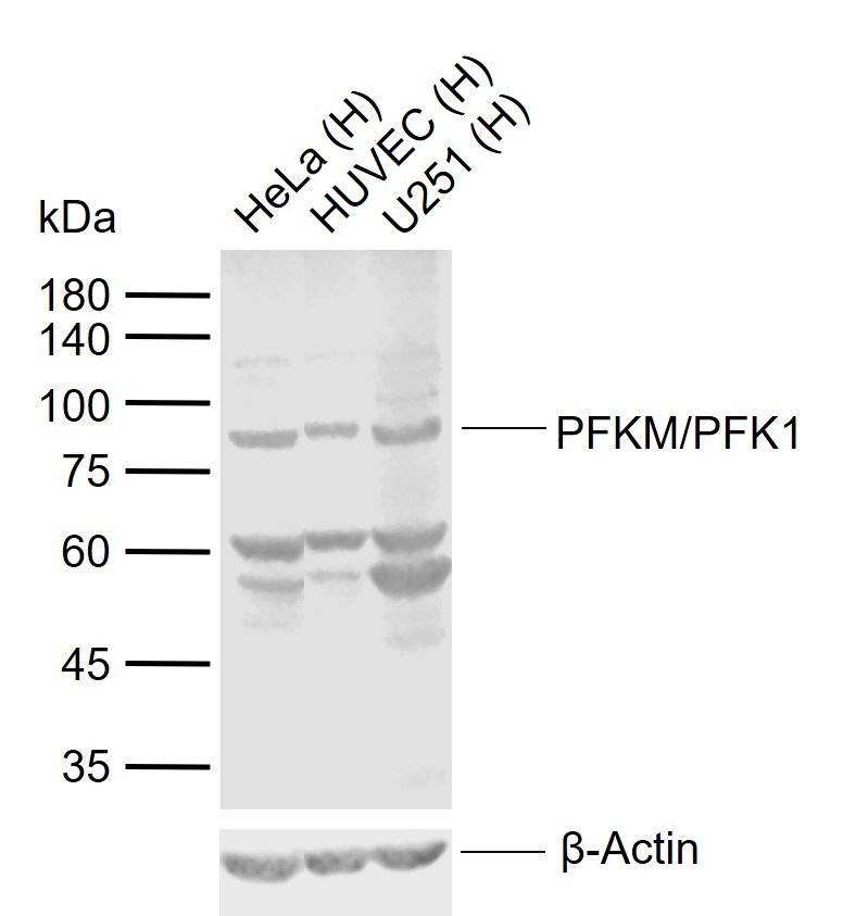 Anti-PFKM Polyclonal Antibody
