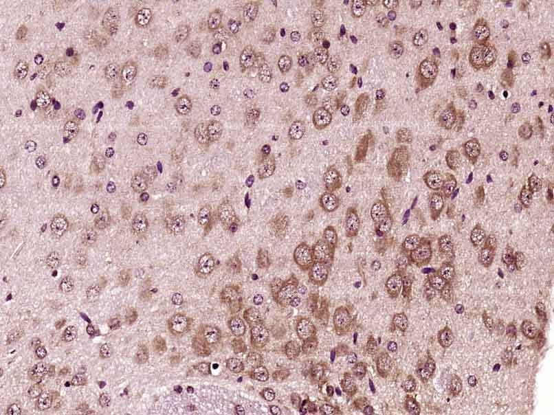 Anti-PFKFB3 Polyclonal Antibody