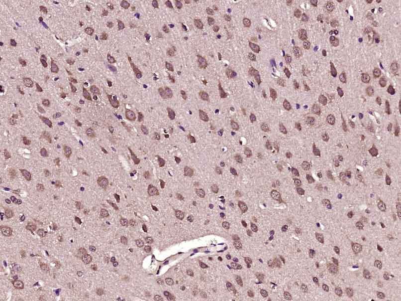 Anti-PFKFB3 Polyclonal Antibody