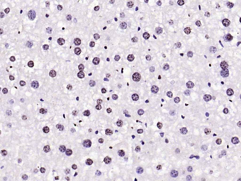 Anti-Phospho-FOXO1 (Ser256) Polyclonal Antibody