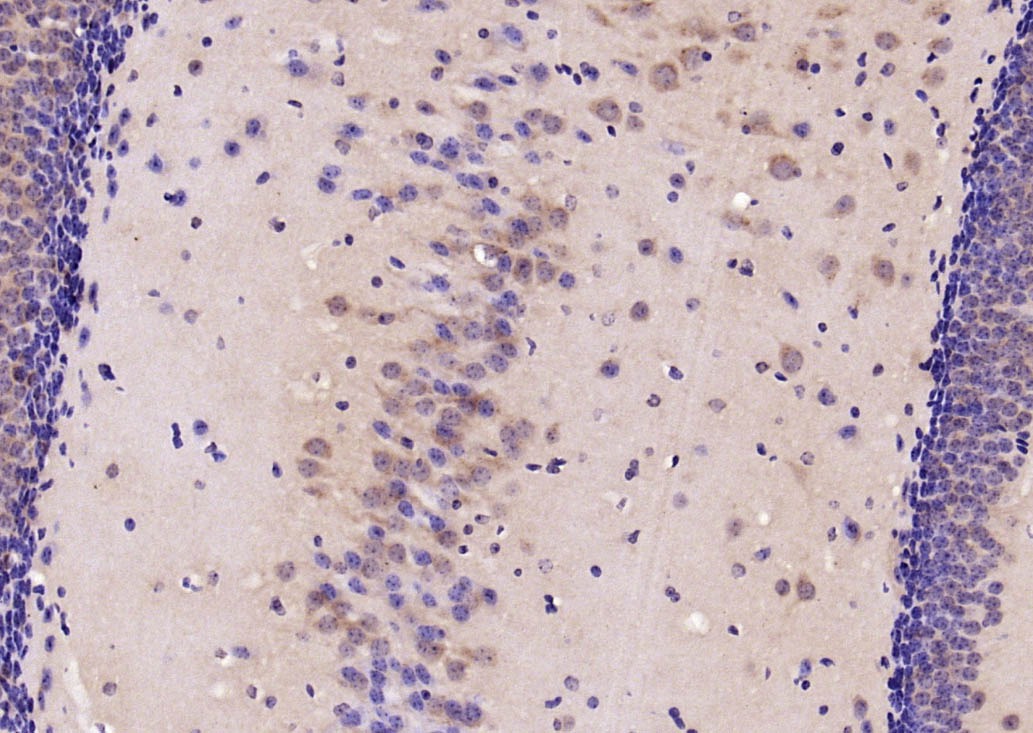 Anti-PERK Polyclonal Antibody