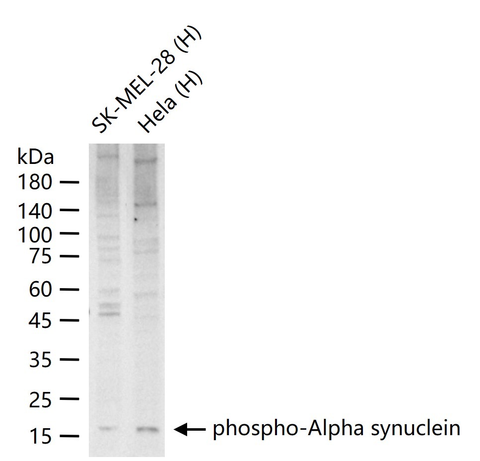 Anti-Phospho-Alpha synuclein (Ser129) Polyclonal Antibody