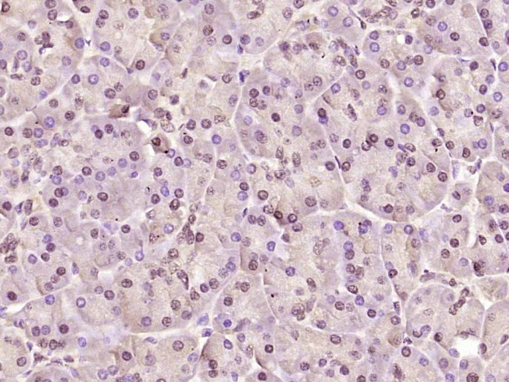Anti-Phospho-AMPK alpha 1 (Thr183) Polyclonal Antibody