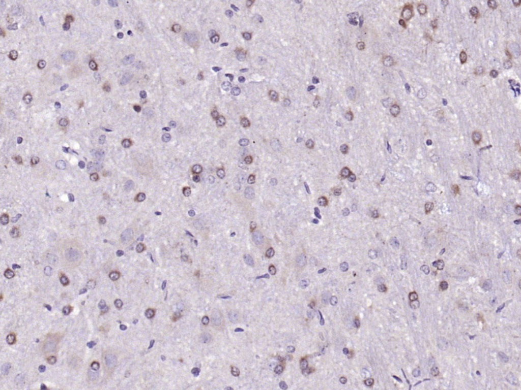 Anti-Phospho-HMGCR (Ser872) Polyclonal Antibody