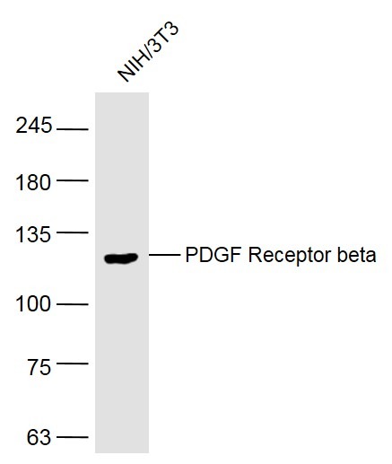 Anti-PDGF R beta/CD140b Polyclonal Antibody