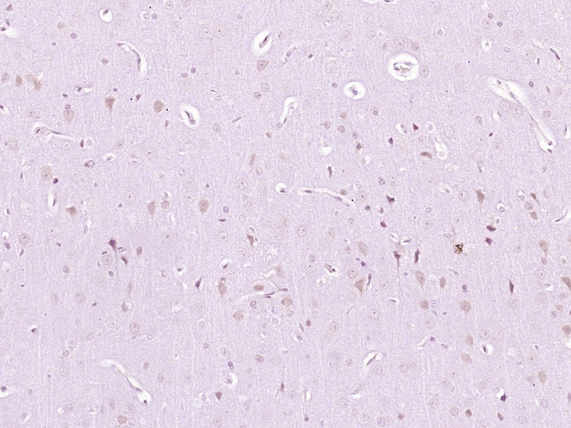 Anti-Phospho-AKT3 (Ser472) Polyclonal Antibody