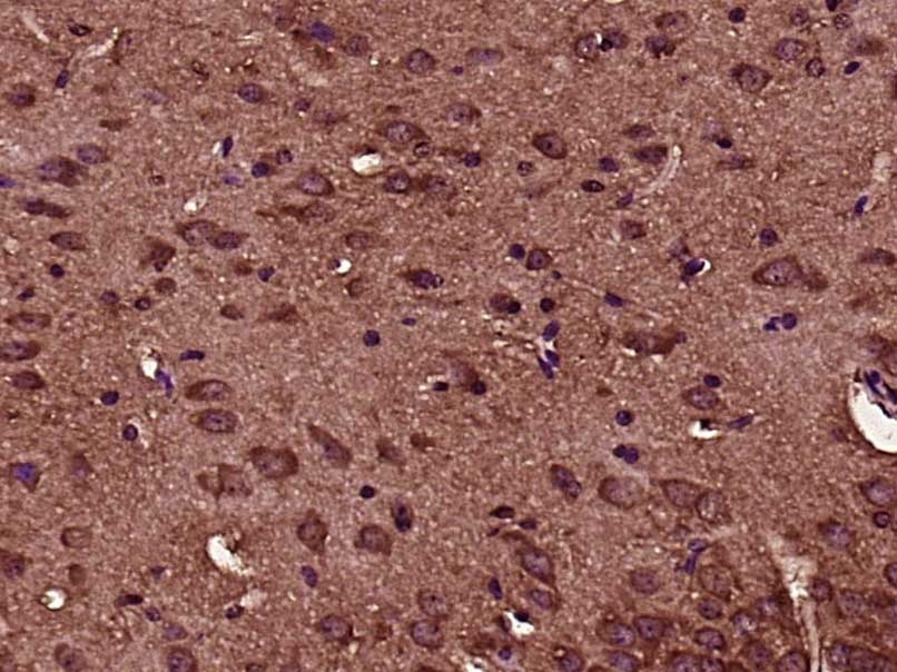 Anti-Phospho-IkB alpha/NFKBIA (Ser32) Polyclonal Antibody