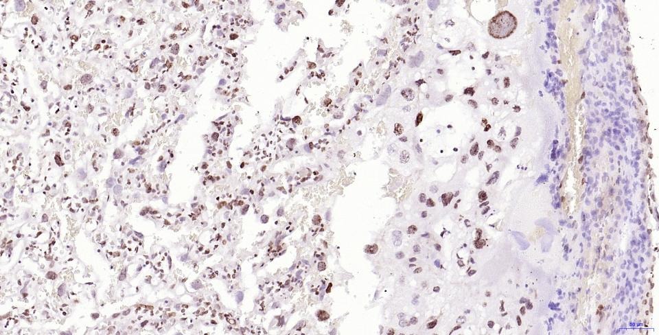 Anti-Phospho-H2AFX (Ser139) Antibody (2T270)