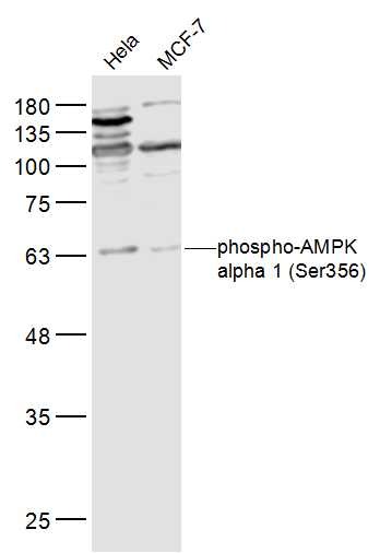 Anti-Phospho-AMPK alpha 1 (Ser356) Polyclonal Antibody