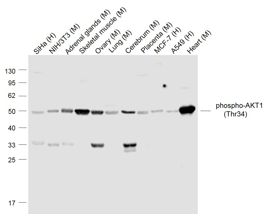 Anti-Phospho-AKT1 (Thr34) Polyclonal Antibody
