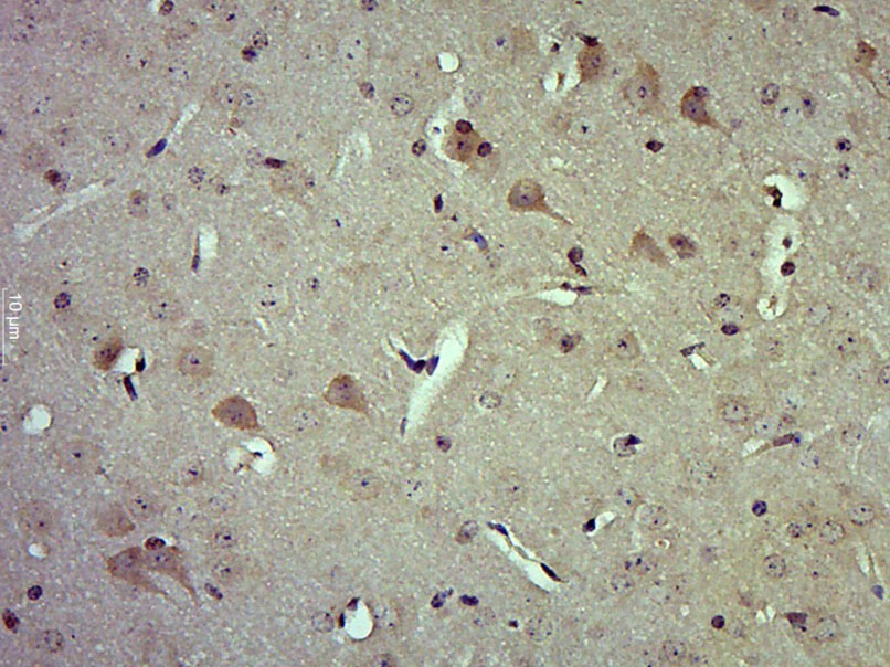 Anti-Phospho-Hck (Tyr411) Polyclonal Antibody