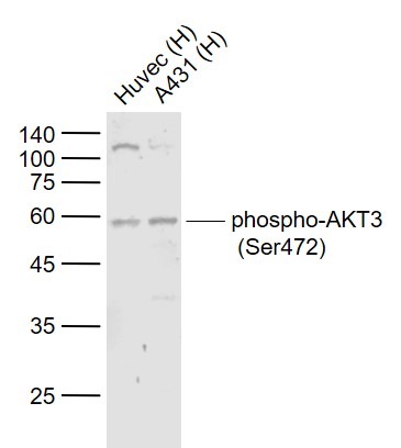 Anti-Phospho-AKT3 (Ser472) Polyclonal Antibody