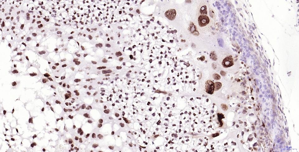 Anti-Phospho-H2AFX (Ser139) Antibody (2T270)