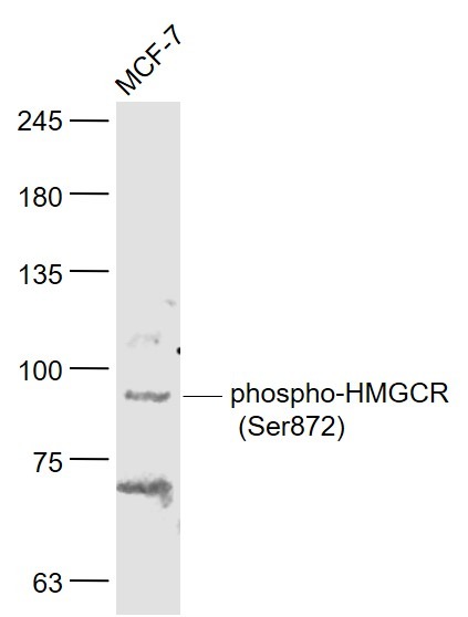 Anti-Phospho-HMGCR (Ser872) Polyclonal Antibody