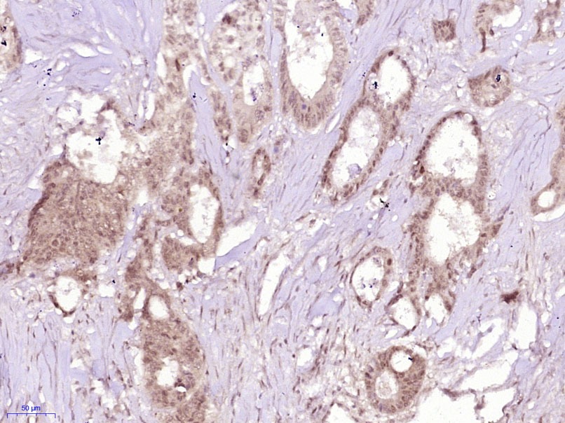 Anti-Phospho-AMPK alpha 1/2 (Thr183, 172) Polyclonal Antibody