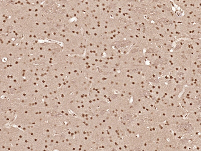 Anti-Phospho-AMPK alpha 1 (Ser356) Polyclonal Antibody