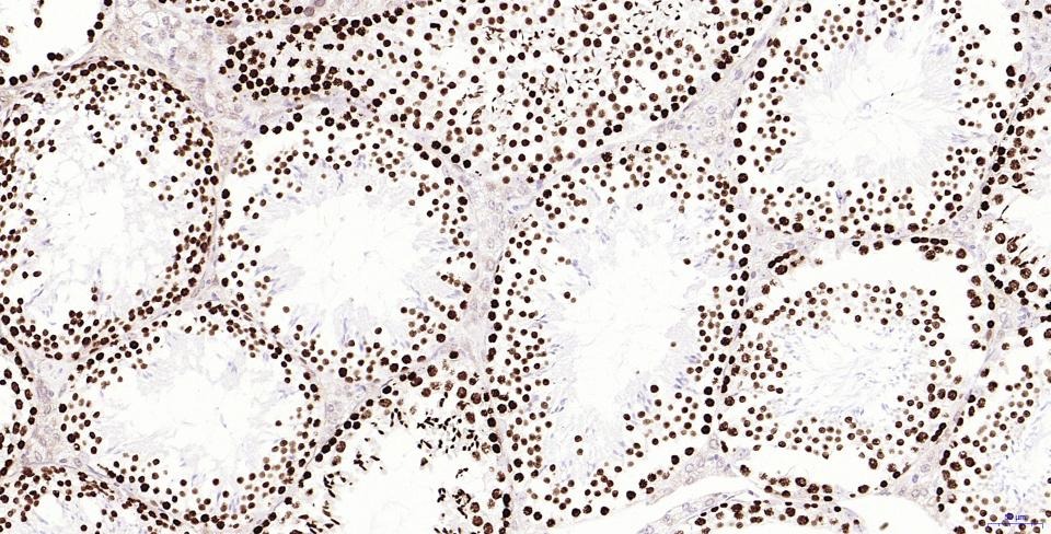 Anti-Phospho-H2AFX (Ser139) Antibody (2T270)