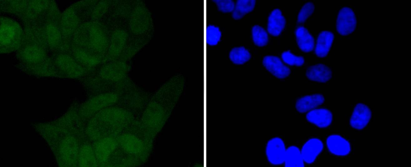 Anti-Phospho-IkB alpha/NFKBIA (Ser32) Antibody (7N349)