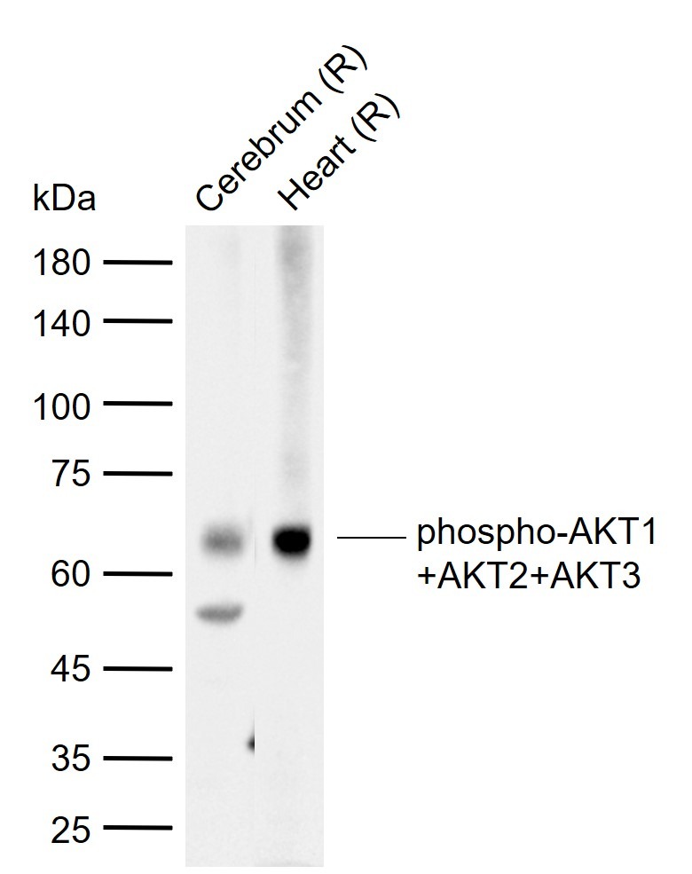 Anti-Phospho-AKT1/AKT2/AKT3 (Tyr315, 316, 312) Polyclonal Antibody