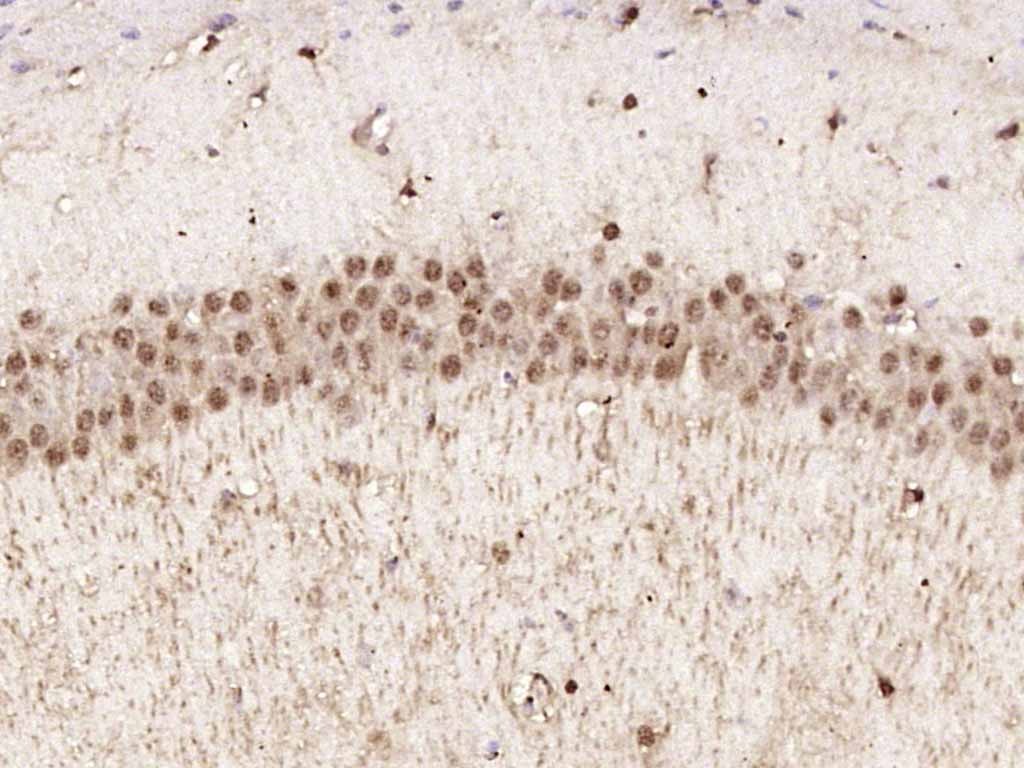 Anti-Phospho-AMPK alpha 1 (Thr183) Polyclonal Antibody