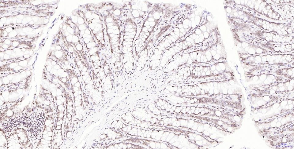 Anti-Phospho-H2AFX (Ser139) Antibody (2T270)