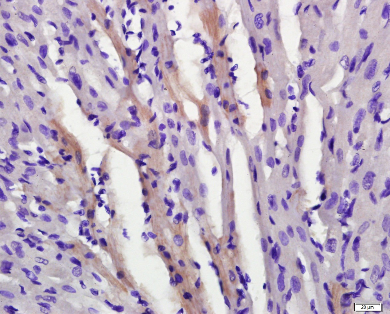 Anti-Phospho-AMPK alpha 2 (Ser173) Polyclonal Antibody