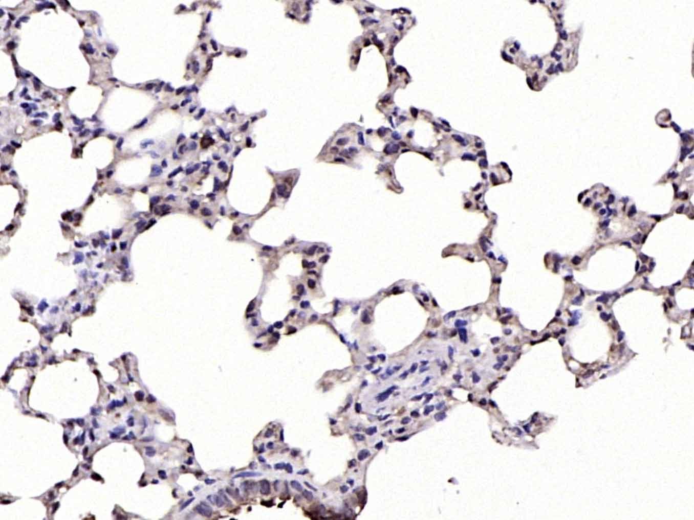 Anti-Phospho-IkB alpha/NFKBIA (Ser32) Polyclonal Antibody