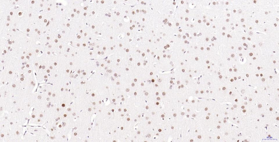 Anti-Phospho-H2AFX (Ser139) Antibody (2T270)