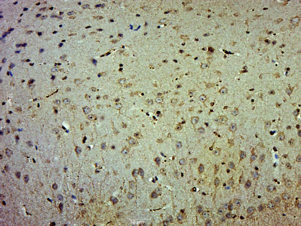 Anti-Phospho-AKT1/AKT2/AKT3 (Tyr315, 316, 312) Polyclonal Antibody