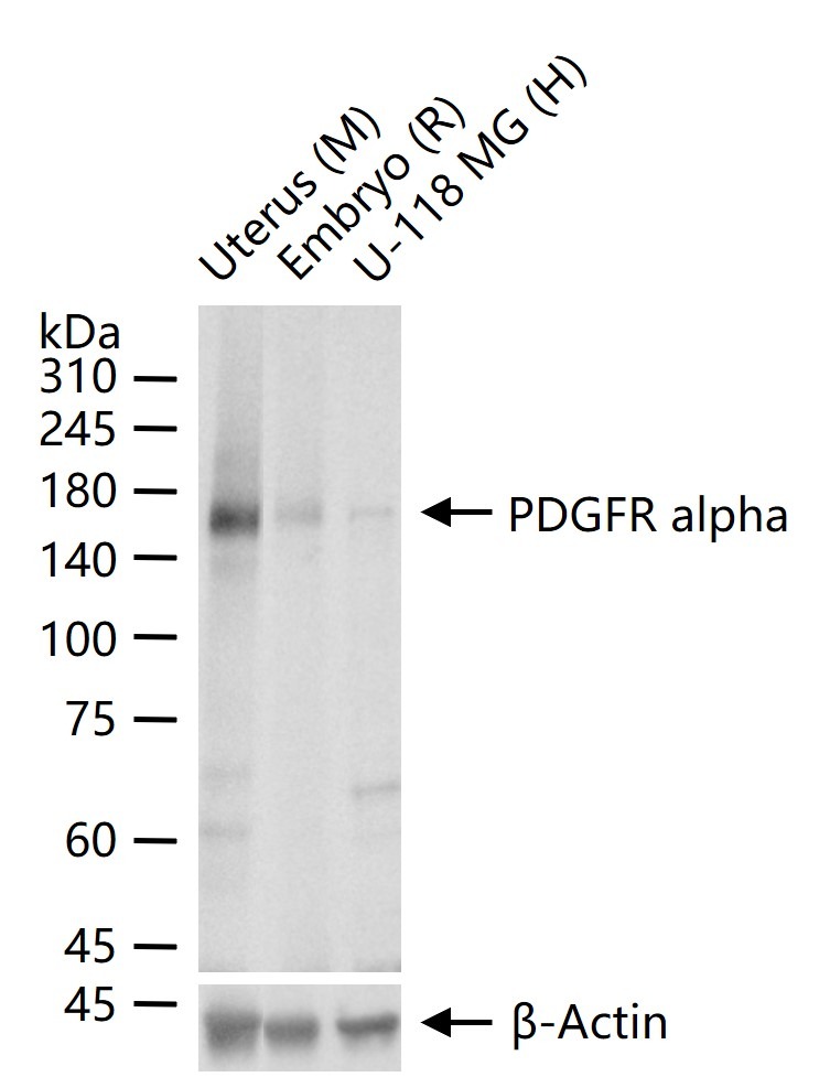 Anti-PDGF R alpha/PDGFRA Antibody (8H467)