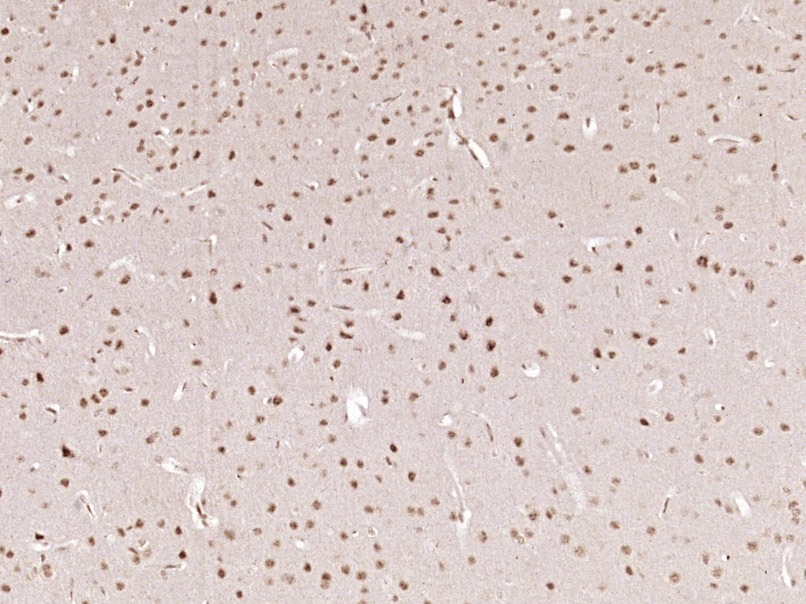 Anti-Phospho-AMPK alpha 1/2 (Thr183, 172) Polyclonal Antibody
